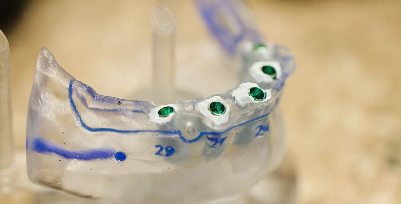 Jacksonville FL Dental Implant Dentists