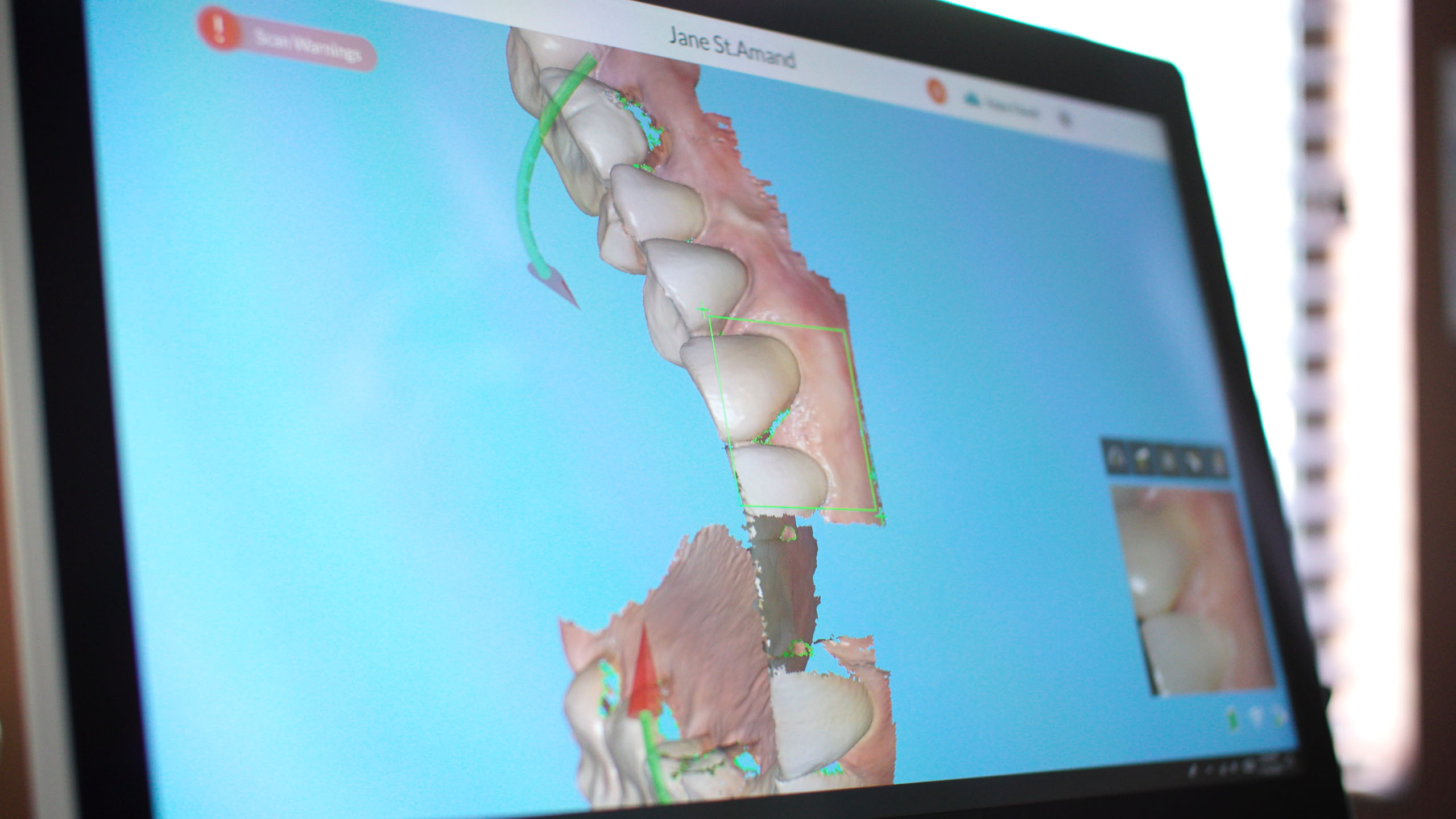 Jacksonville FL Clear Aligner Dentists