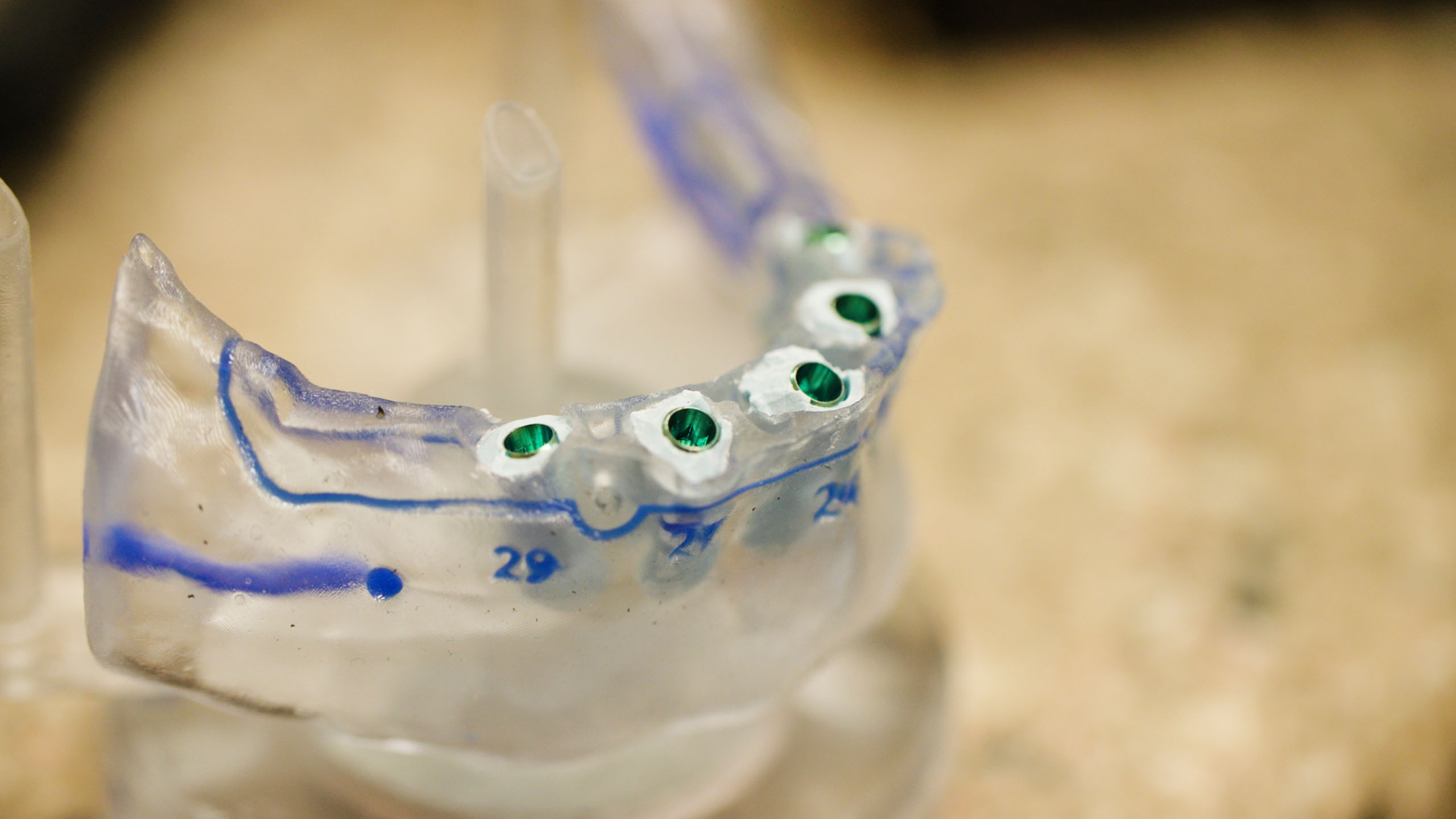Jacksonville Fl Denture Dentists